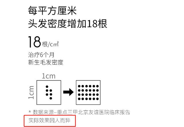 雷军管管？小米有品未做大就开始收智商税 众筹竟上架激光生发帽