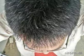 日本纯植物染发剂！春节送爸妈，白发5分钟变黑！