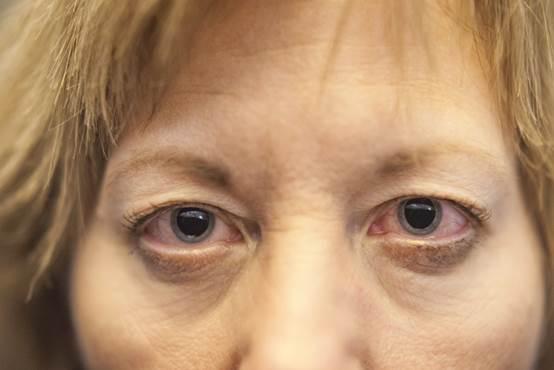 眼部护理刻不容缓，这8款人气眼霜让眼睛“重现光彩”