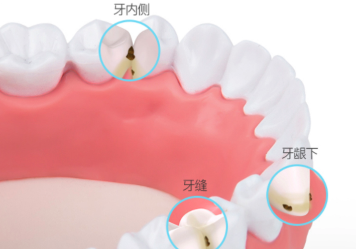 657ee8b18c244e25b2ac28996c34fc72?from=pc