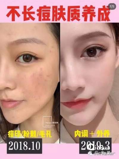 新手如何做好小红书运营推广？分享几个小红书推广技巧