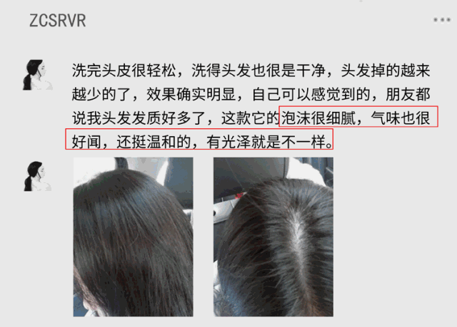 袁咏仪用的洗发水让人惊讶，比沙宣便宜，去屑控油又不输飘柔