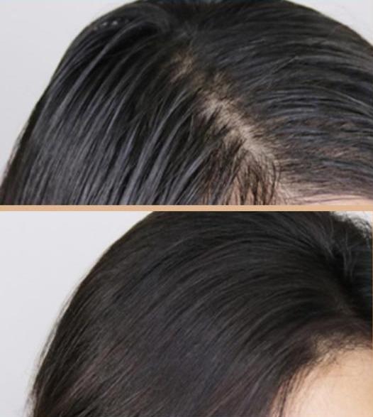 袁咏仪用的洗发水让人惊讶，比沙宣便宜，去屑控油又不输飘柔