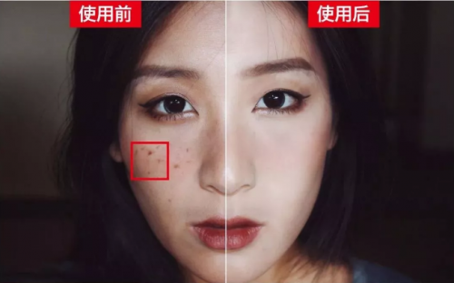 解决斑点问题，浪漫香榭丽我看行