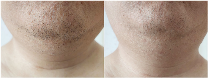 胡须也可以修剪得很精细，飞利浦小T剃须刀详细体验