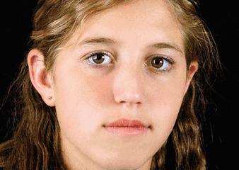 解决斑点问题，浪漫香榭丽我看行