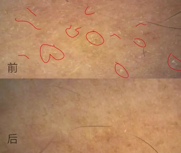 形象美玻尿酸和烟酰胺安瓶 | 实测