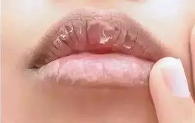 在这个寒冷干燥的冬天唇膏应该怎么选？