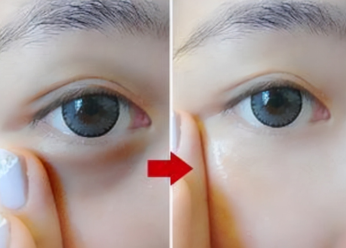 眼霜用得好不显老！4种适合40岁女人的眼霜，好用还不贵