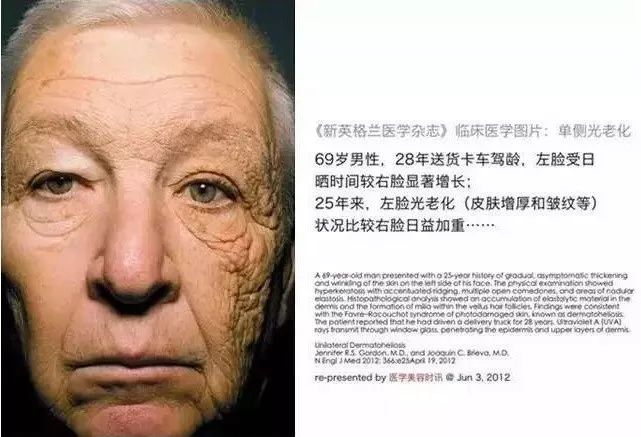 卖爆了的欧莱雅小金管！清爽不油腻，让你狂晒不怕黑