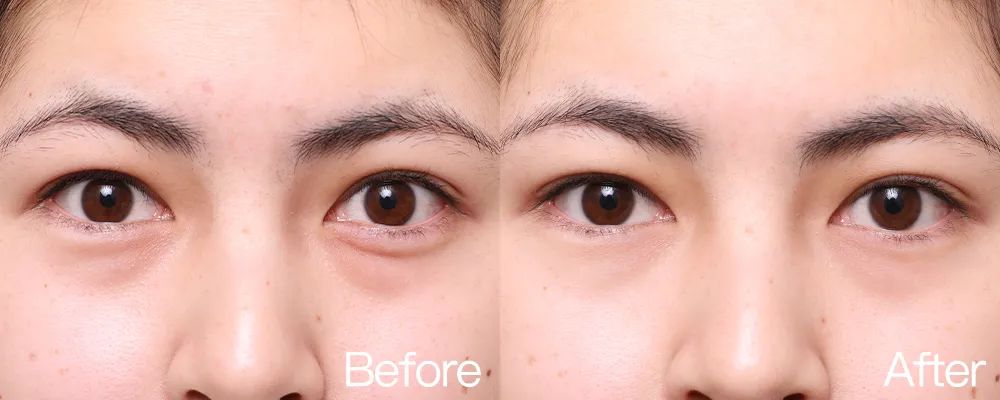 小茂专家团特别版｜雅诗兰黛黑松露眼霜