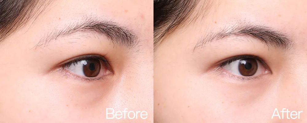 小茂专家团特别版｜雅诗兰黛黑松露眼霜