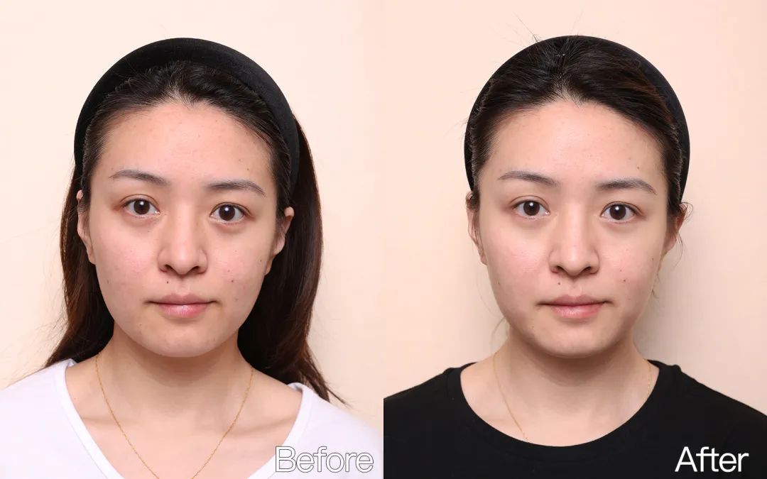 小茂专家团特别版｜雅诗兰黛黑松露眼霜