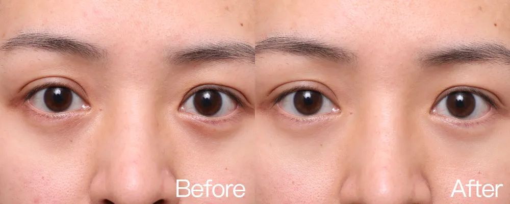 小茂专家团特别版｜雅诗兰黛黑松露眼霜