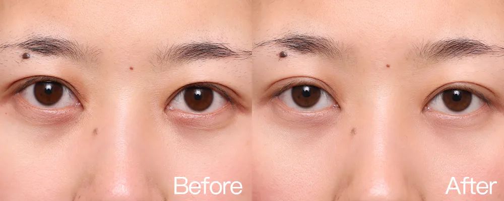 小茂专家团特别版｜雅诗兰黛黑松露眼霜