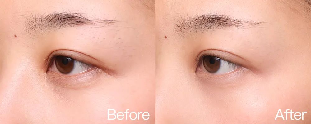 小茂专家团特别版｜雅诗兰黛黑松露眼霜