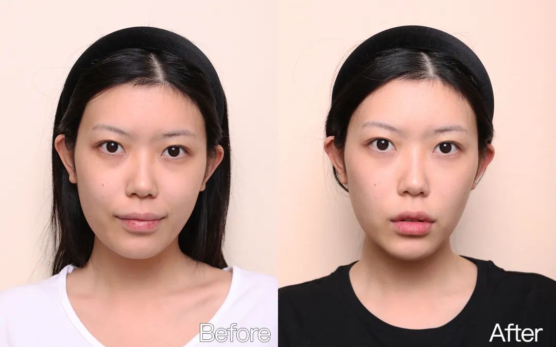 小茂专家团特别版｜雅诗兰黛黑松露眼霜