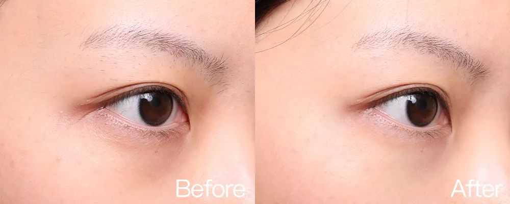 小茂专家团特别版｜雅诗兰黛黑松露眼霜