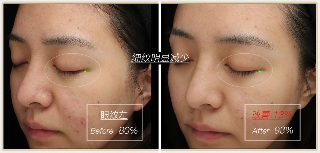 小茂专家团特别版｜雅诗兰黛黑松露眼霜