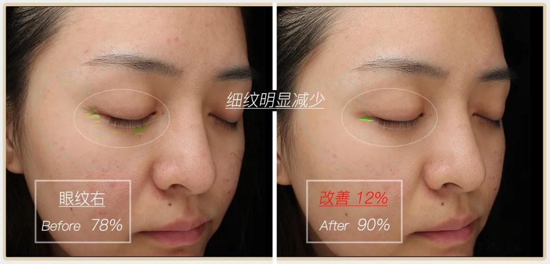 小茂专家团特别版｜雅诗兰黛黑松露眼霜