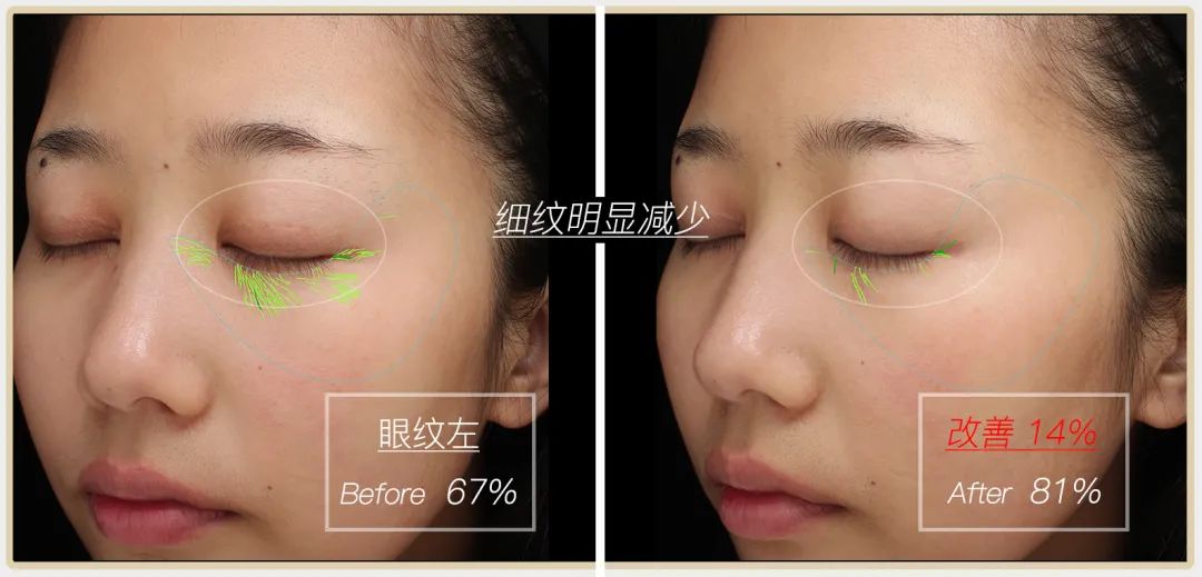 小茂专家团特别版｜雅诗兰黛黑松露眼霜