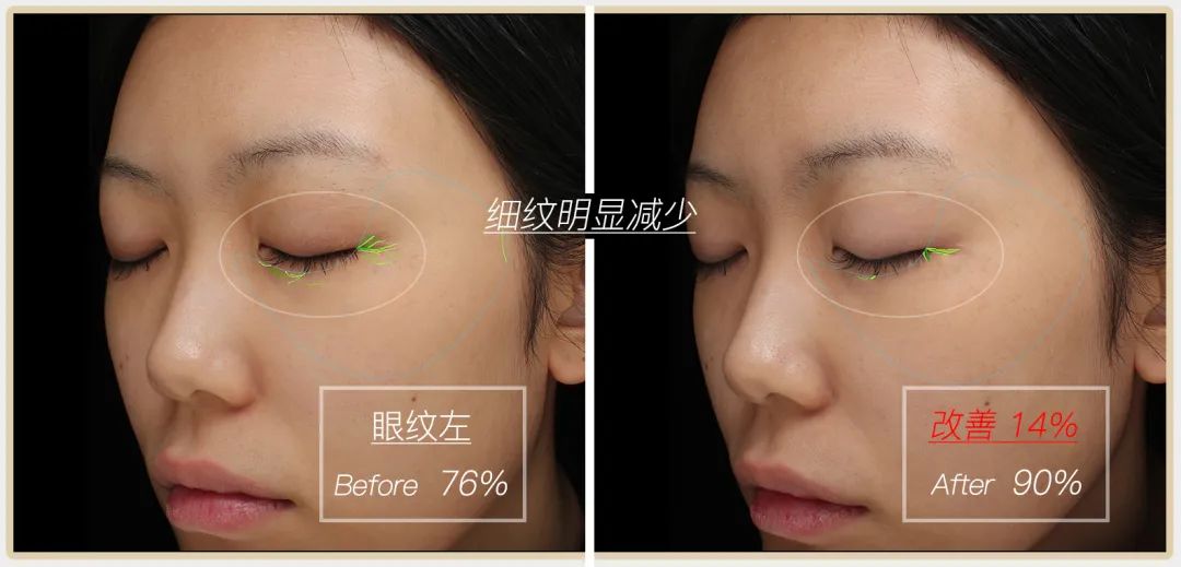 小茂专家团特别版｜雅诗兰黛黑松露眼霜