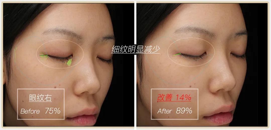 小茂专家团特别版｜雅诗兰黛黑松露眼霜