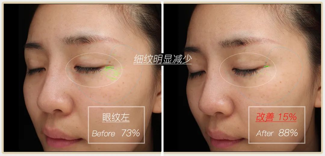 小茂专家团特别版｜雅诗兰黛黑松露眼霜