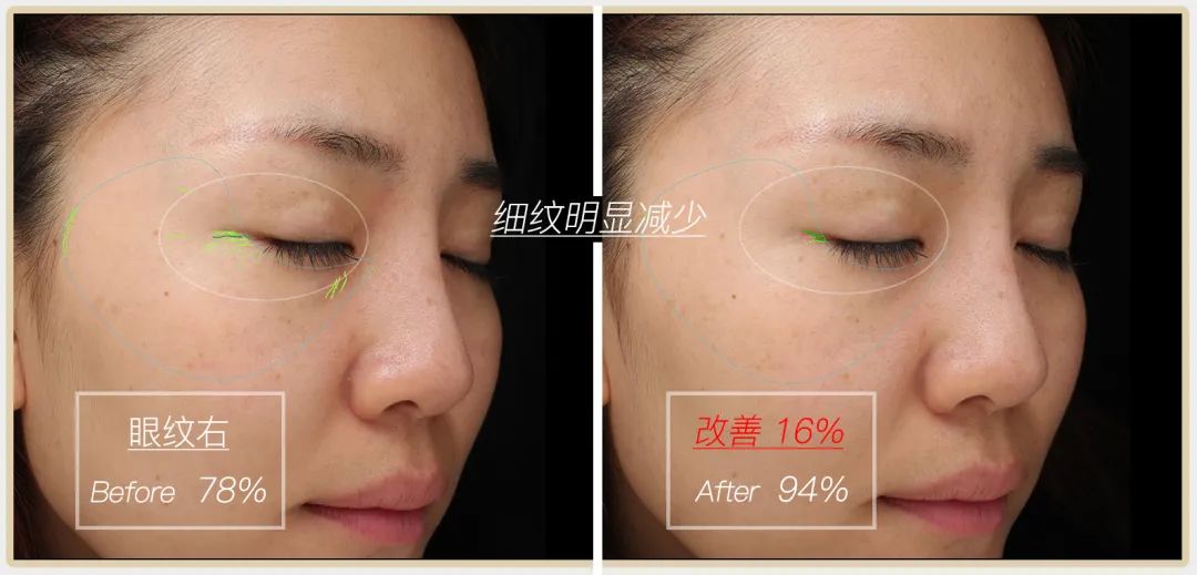 小茂专家团特别版｜雅诗兰黛黑松露眼霜